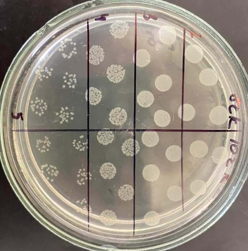 Игра "«Дифференцируем» микробов: зачем и как моделировать рост микроорганизмов"